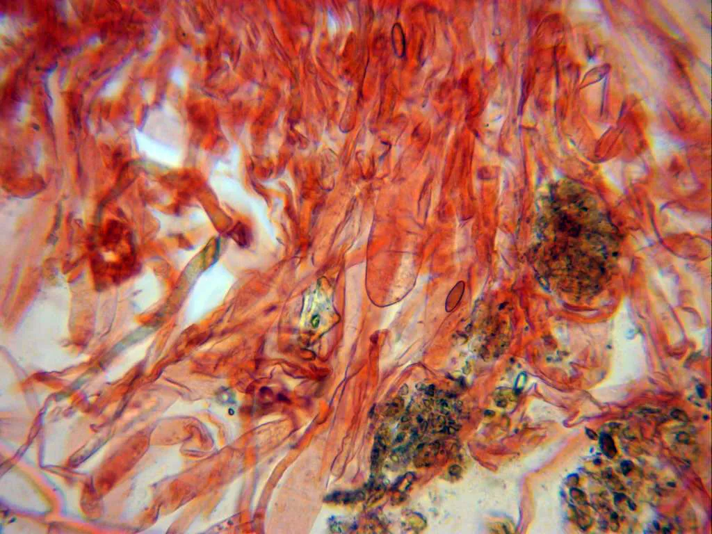 Microscopía de Xerocomellus persicolor - 17 - Pileipellis rojo congo x 400